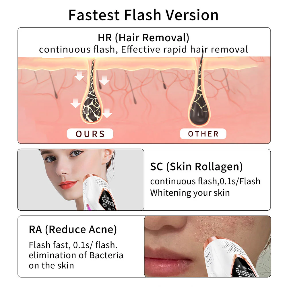 Rechargeable Electric Epilator – Cordless Hair Removal Device for Smooth Skin - Image 7